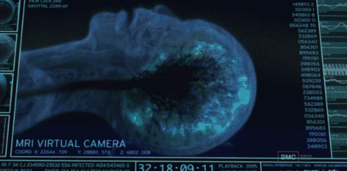 人間が死ぬ瞬間のMRI映像…驚愕の瞬間はまるで・・・