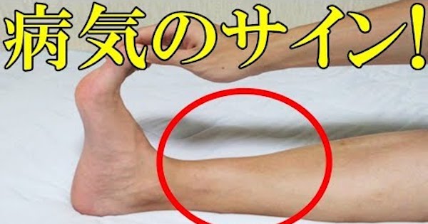 寝起きに足がつる人は恐ろしい病気のサインかも 頻繁に足がつる人は要注意 バズニュース速報