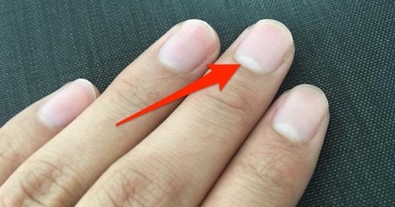 爪半月の大きさが人によって違う秘密 爪の白い部分が小さい人は危険 バズニュース速報